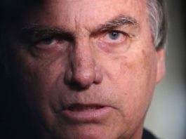 Médico recomenda cirurgia rápida para Bolsonaro após diagnóstico confirmado na sede da Superintendência da PF; veja