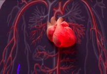 Por que 40% dos casos de infarto ocorrem em pessoas com um baixo risco de problemas cardiovasculares; leia mais