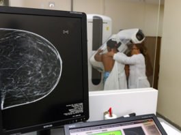 Projeto aprovado na Câmara muda legislação para garantir mamografia no SUS a mulheres a partir dos 40 anos