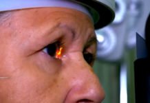 Sobe para treze número de pessoas que perderam a visão após cirurgia de catarata em clínica particular de Salvador