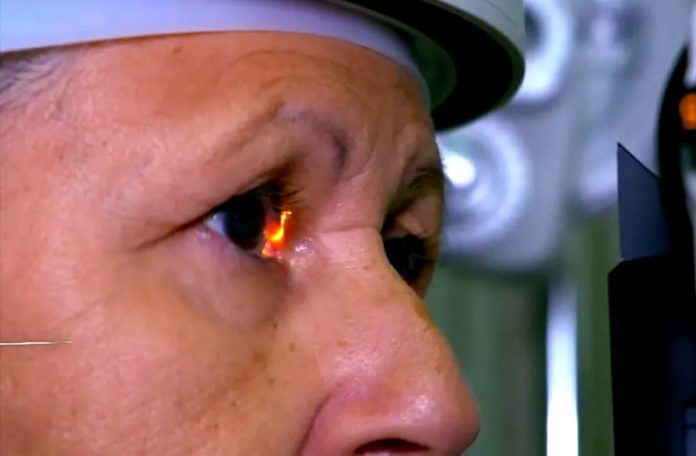 olhos