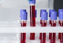 HIV: Sesab desmente surto entre jovens na Bahia e alerta para fake news; só 93 notificações foram registradas em 2025