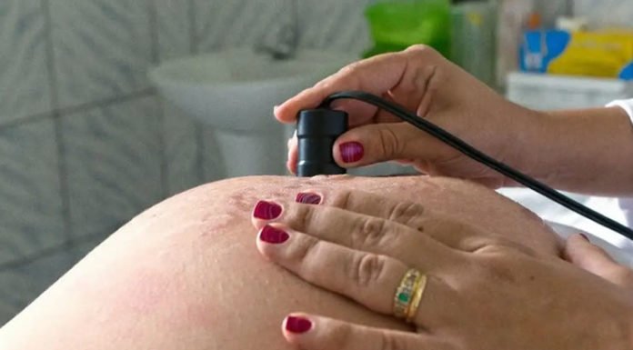Pesquisa revela desigualdades em escolhas de parto no Brasil; fatores sociais e estruturais favorecem cesarianas