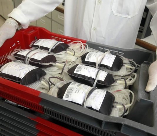 As novas regras das Testemunhas de Jeová para transfusão de sangue que pode ser removido e armazenado; entenda