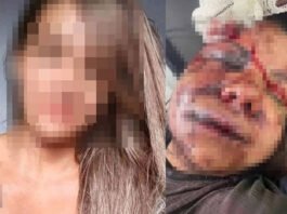 Ciúmes e celular jogado na piscina: veja o que ocorreu antes de ex-jogador de basquete espancar namorada em elevador