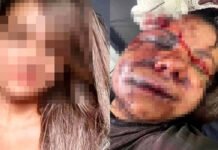 61 socos: caso no RN retrata escalada da violência contra mulheres; episódio chamou atenção de todo o país