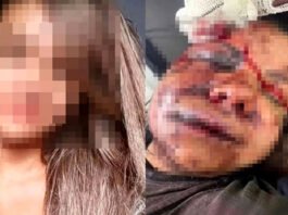 61 socos: caso no RN retrata escalada da violência contra mulheres; episódio chamou atenção de todo o país