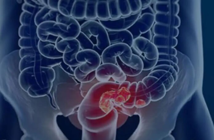 intestino