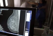 Ministério da Saúde passa a recomendar mamografia a partir dos 40 anos