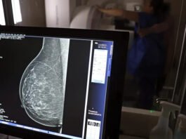 Ministério da Saúde passa a recomendar mamografia a partir dos 40 anos