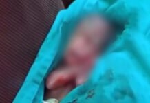 Bebê dado como morto retirado do próprio velório no AC respira com ajuda de aparelhos, diz Saúde