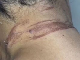 Mulher de 45 anos denuncia que foi enterrada viva pelo ex-namorado após tentativa de feminicídio no sul da Bahia