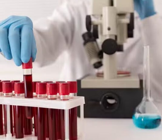Três sinais no sangue que podem revelar o risco oculto de doenças do coração, segundo estudo