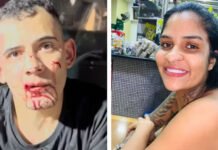 Mulher que teve pernas amputadas após ser atropelada e arrastada passa por 3ª cirurgia: ‘Foi um sucesso’, diz família