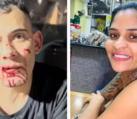 Mulher que teve pernas amputadas após ser atropelada e arrastada passa por 3ª cirurgia: ‘Foi um sucesso’, diz família