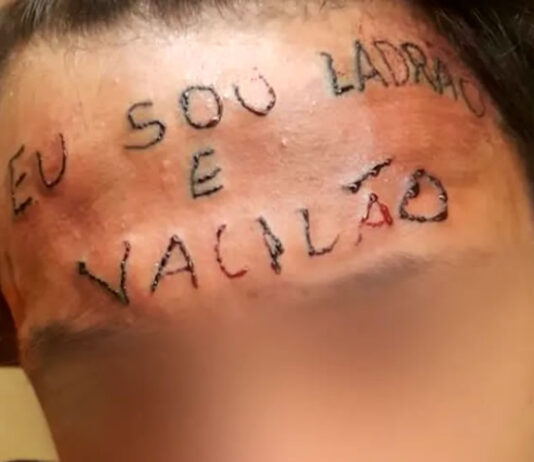 Jovem que teve testa tatuada com frase ‘eu sou ladrão e vacilão’ é preso após furtar unidade de saúde em Diadema