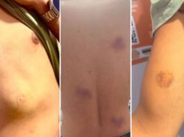 Justiça determina afastamento de PMs após denúncia de agressões e insultos homofóbicos no carnaval de Salvador