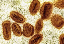 Bahia registrou dois casos de Mpox em 2026, confirma a Secretaria de Saúde e outros dois casos são investigados; veja
