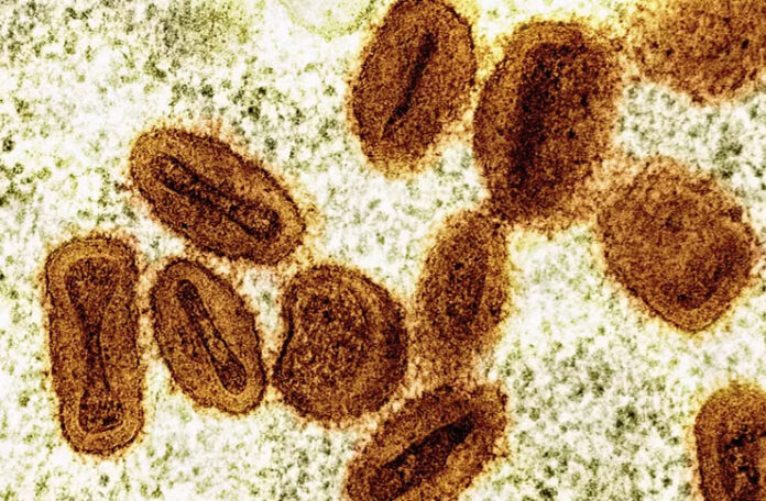 mpox