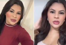 Jovem de 21 anos que teve mãos decepadas em tentativa de feminicídio no Ceará aprende a usar celular com os pés