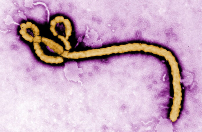 ebola