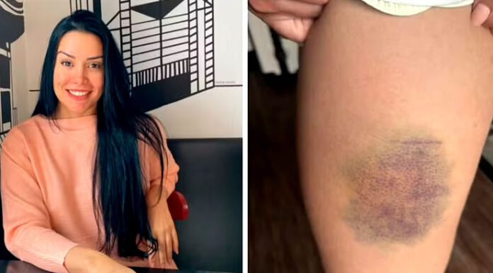 Nutricionista que lutou para não ser estuprada teve aula de defesa pessoal com simulação de tentativa de estupro