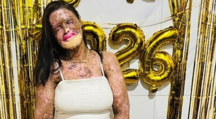 Káh Felipe, influenciadora que lutava contra doença rara, morre aos 36 anos
